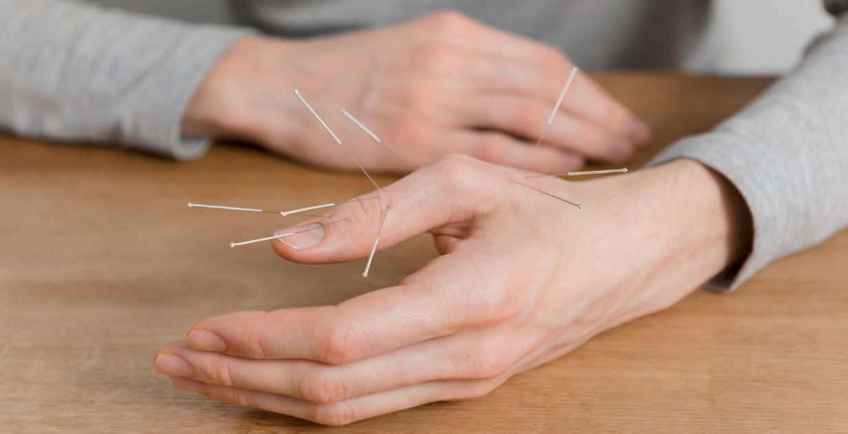 Stillpoint Community Acupuncture